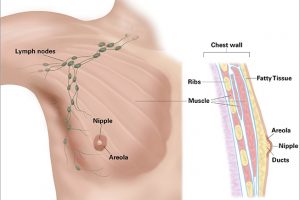শুধু নারী নয় পুরুষদের মধ্যেও দেখা যায় ব্রেস্ট ক্যান্সার